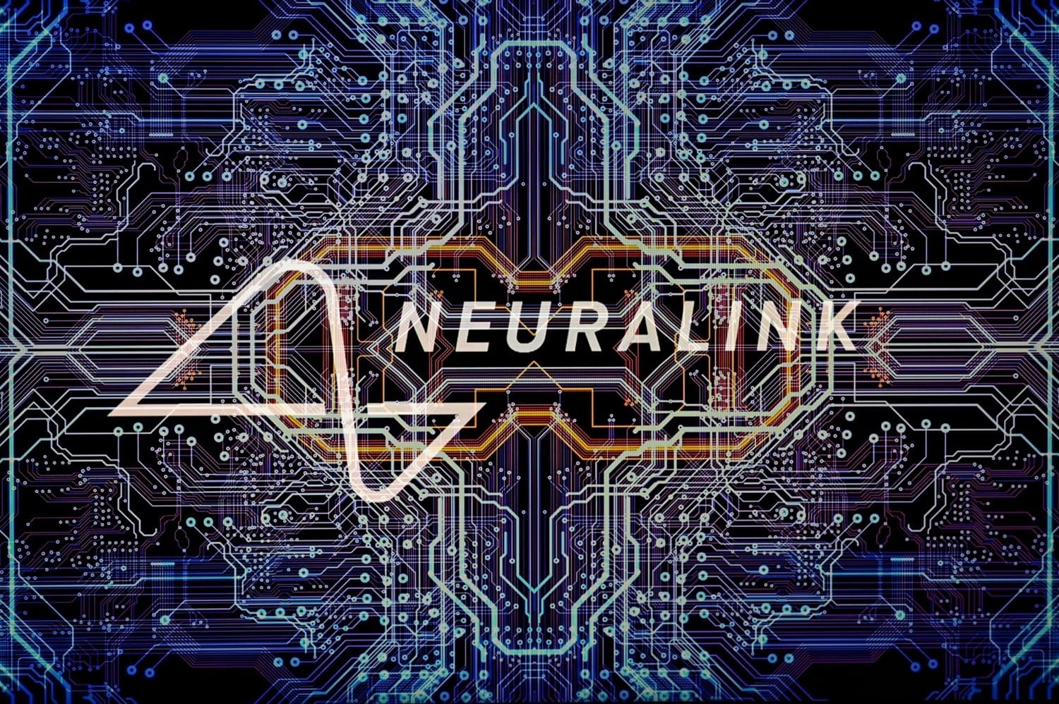 neuralink-in-beyin-implantini-elde-etmis-ikinci-pasient-fikir-gucu-vasitesile-counter-strike-oynamagi-oyrenib-video